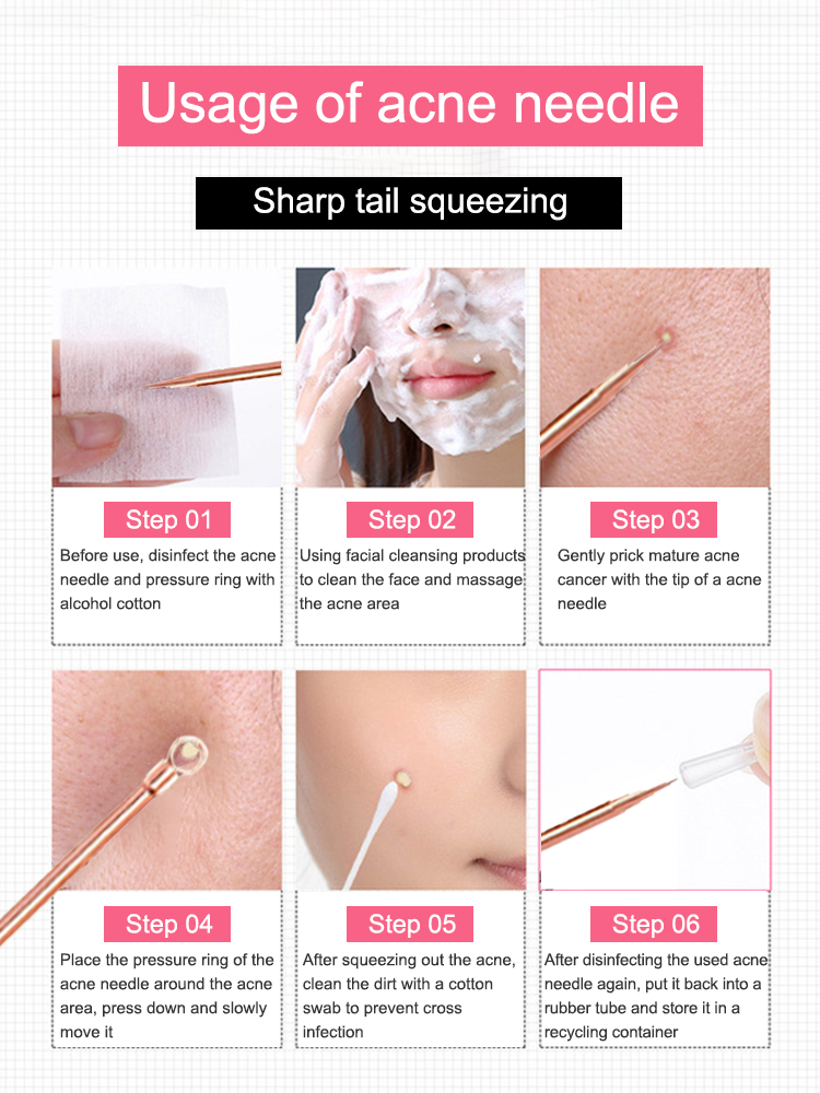 Alat pelepas komedo, alat ekst - Luxury Skincare Acne ulasan dan harga