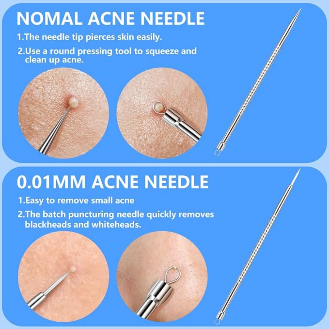 5PCS Kit Penghilang Komedo dan - Luxury Skincare Acne ulasan dan harga
