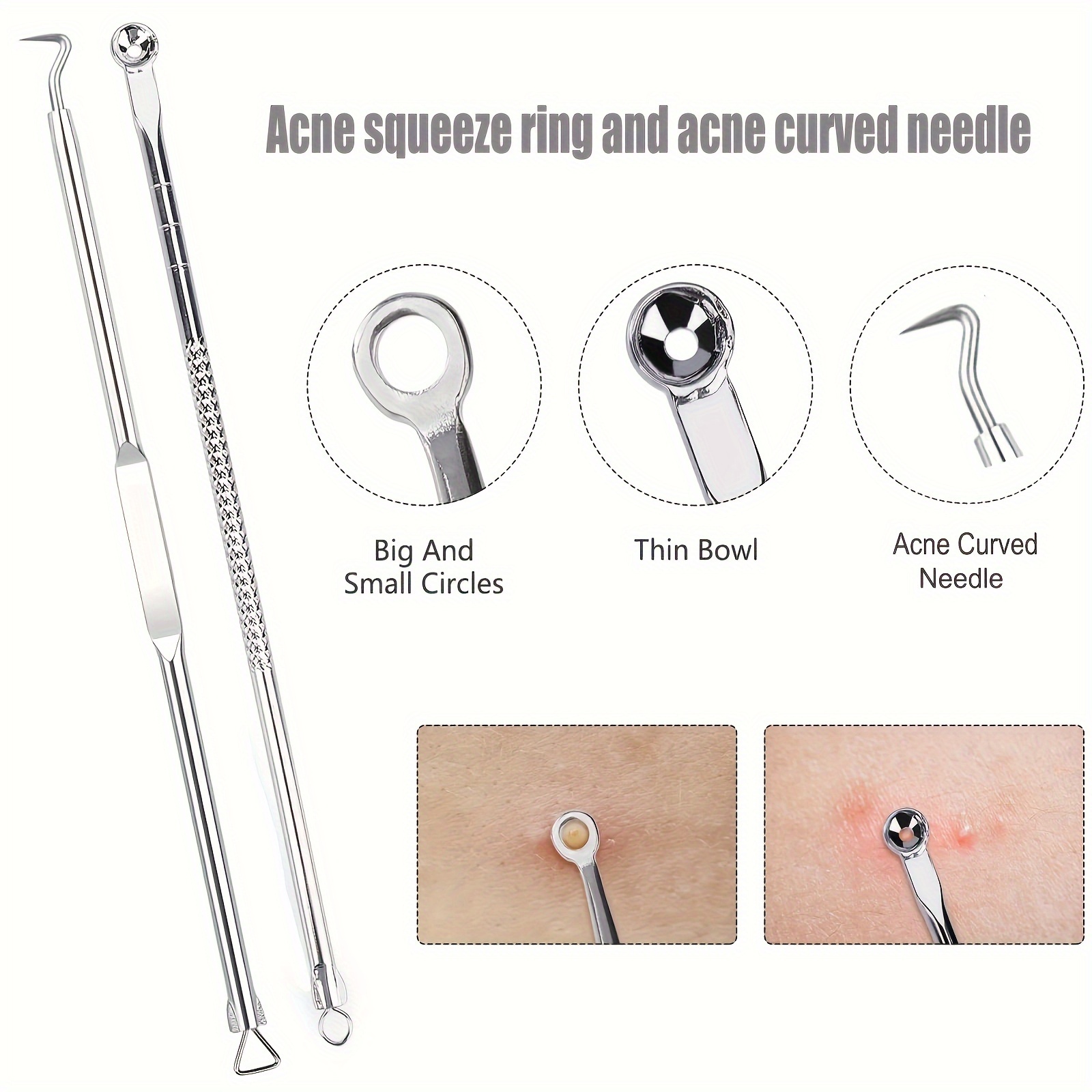 ​ 6Pcs Alat Penghilang Komedo  - Luxury Skincare Acne ulasan dan harga
